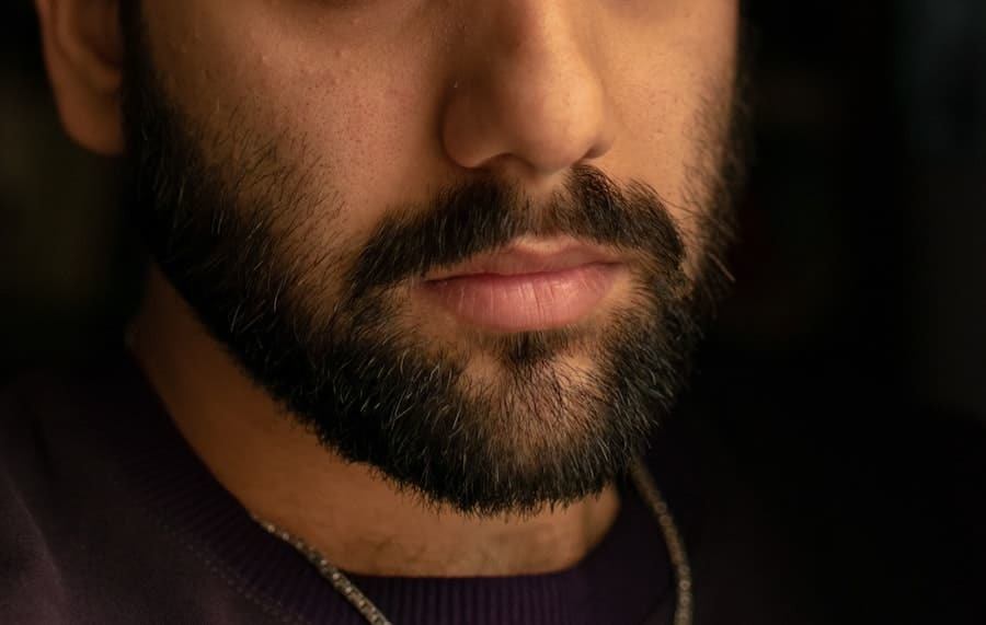 man with beard